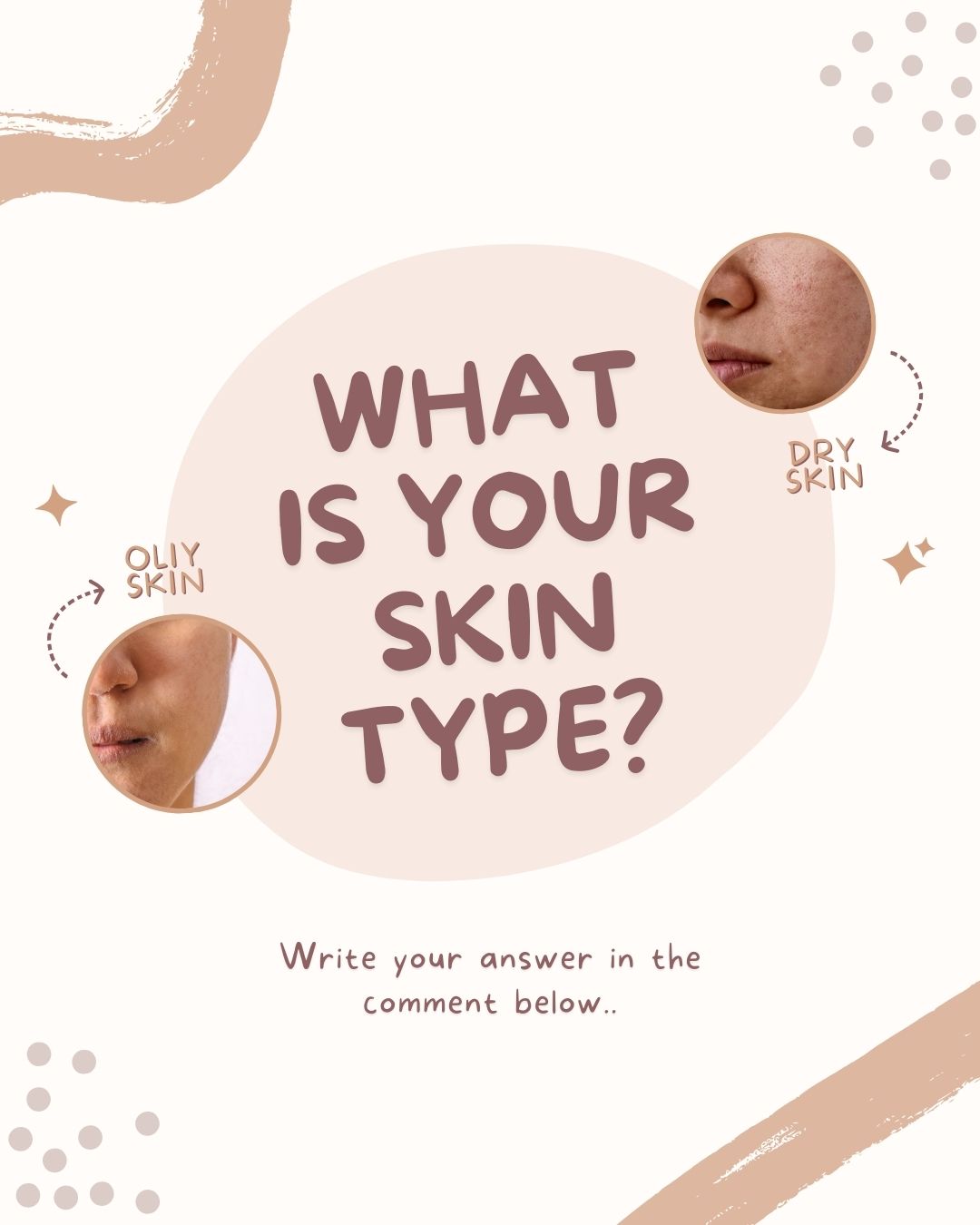 What is your Skin Type?